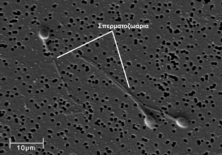 Φωτογραφία: Σπερματοζωάρια στο ηλεκτρονικό μικροσκόπιο