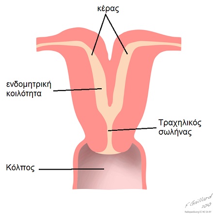 Εικόνα 2: Δίκερως Μήτρα