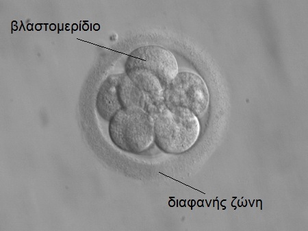 Φωτογραφία: Έμβρυο 3 ημέρες μετά τη γονιμοποίηση (8 κύτταρα)