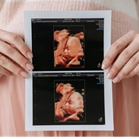 ΠΡΟΓΡΑΜΜΑ ΠΑΡΑΚΟΛΟΥΘΗΣΗΣ ΤΗΣ ΕΓΚΥΜΟΣΥΝΗΣ